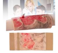 Modèle de simulation de brûlure réutilisable, soins des plaies 2e/3e degrés | Modèle de simulation de brûlure réutilisable, soins des plaies 2e/3e degrés, entraînement premiers secours de base, pansement