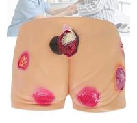 Modèle de soin pour escarres, simulateur avancé pour le soin des escarres, entraînement à l'évaluation des plaies, ulcère en 4 étapes, pour les soins médicaux