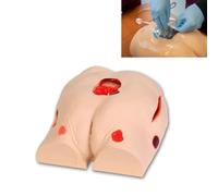 Modèle de soins escarres escarres pour personnes âgées Simulation professionnelle pour la gestion des plaies et des escarres