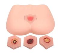 Modèle de soins for escarres, simulant les fesses d'un adulte/Image vivante/Coloration interne/Film externe