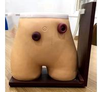 Modèle de soins infirmiers pour stomie de fistule, mannequin d'entraînement à la colostomie grandeur nature pour soins médicaux et pratique du lavement assisté à la défécation