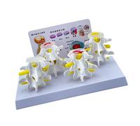 Modèle De Squelette Humain Pour L'anatomie De La Colonne Lombaire Lésions En 4 Étapes Vertèbres Comparatives Soins Infirmiers Colonne Vertébrale Humaine Vertèbres Outil D'enseignement Médical