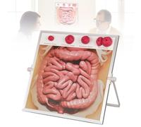 Modèle de Stomie avec Anatomie Intestinale pour Formation Médicale