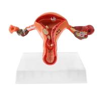 Modèle de structure d'ovaire d'utérus pathologique humain modèle de structure de coupe transversale modèle anatomique d'utérus outil d'étude d'organe féminin