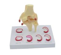 Modèle de suture du ménisque, demi-lune humain grandeur nature, outil d'enseignement des sciences médicales, anatomique