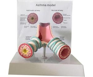 Modèle de trachée et de bronches humaines pour l'étude du système respiratoire, Affichage Anatomique détaillé pour l'enseignement aux étudiants en médecine et à Usage éducatif