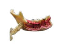 Modèle De Traitement Endodontique Dentaire,Anatomie Des Gencives,Étude Dentaire,Modèle D'enseignement Des Dents
