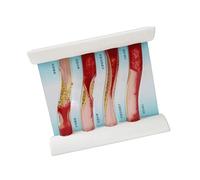 Modèle de vaisseau sanguin de simulation dynamique pour l ' enseignement médical avec effet de flux sanguin réaliste et outil d ' anatomie vasculaire de comparaison pathologique
