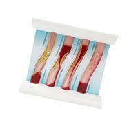 Modèle de vaisseau sanguin de simulation dynamique pour l ' enseignement médical avec effet de flux sanguin réaliste et outil d ' anatomie vasculaire de comparaison pathologique