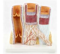 Modèle de vaisseau sanguin grossi 14x avec affichage numérique - Modèle anatomique d'artère et de veine humaine avec socle, démonstration de l'artériosclérose, modèle anatomique de vaisseau