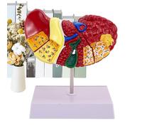 Modèle d'éducation hépatique, modèle d'anatomie hépatique humaine Pathologie anatomique Affichage du foie Modèle de pathologie de l'enseignement du foie, affichage polyvalent et lumineux Modèle de