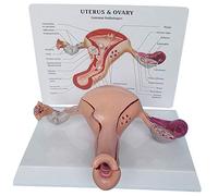 Modèle d'enseignement humain Anatomical Utérus - Utérus Ovaire Modèle anatomique avec Pathologies Simulation avancée maternelle Utérus Structure Anatomie Pathologique Utérus Modèle de démonstration