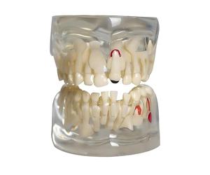 Modèle d'enseignement, modèle Dentaire Transparent pour Enfants, démonstration de Dents de Lait pour l'enseignement de l'anatomie des Dents primaires