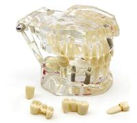 Modèle dentaire de réparation neurale, modèle pédagogique de dents amovibles pour l'enseignement de l'anatomie et de la pathologie en école dentaire, outil pédagogique de démonstration(White)