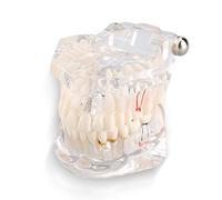 Modèle Dentaire,Dentaires Modèle de Dents de Démonstration de Typodont Adulte Modèle de Dents Standard pour Modèle d'éducation dentaire pour Médical et Dentiste