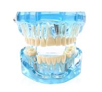 Modèle Dentaire, Modèle De Dents, 9*7*6 Cm Modele Dentaire Pedagogique, Amovible Démonstration Dentaire Standard Pour Les Étudiants, Éducation, L'Étude Et Démonstrations Pratique, Bleu Transparent