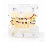 Modele Dentaire Pedagogique Transparent, Modèle de démonstration d'orthodontie Dentaire avec Dents Résine et Fil Métallique, Modèle Dents Standard avec appareil dentaire, pour Laboratoires Scolaires