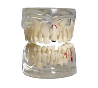 Modèle dentaire transparent pour enfants : démonstration de dents de lait pour l'enseignement de l'anatomie des dents primaires