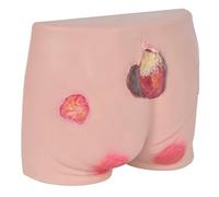 Modèle d'entraînement en soins infirmiers pour l'évaluation des ulcères de pression, simulation d'escarres en quatre étapes avec matériau en silicone souple, outil éducatif pour la classification des