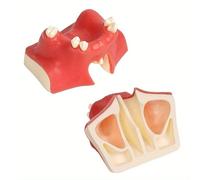 Modèle d'entraînement pour le levage du sinus maxillaire - Modèle d'entraînement pour le levage du sinus maxillaire - Modèle d'entraînement pour le sinus maxillaire et les implants dentaires - Modèle