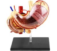 Modèle d'estomac et de pancréas humains, modèle d'anatomie gastrique, modèles d'organes digestifs humains 1:1, outil pédagogique d'anatomie de pathologie de l'estomac, for l'apprentissage