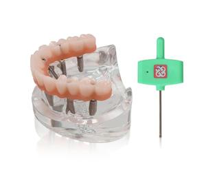 Modèle d'implant dentaire à double arcade, système de formation pour prothèses supra-dentaires All-On-6 et All-On-4, bases transparentes pour maxillaire et mandibule