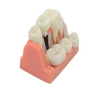 Modèle d'implant dentaire flexible pour étudier le module d'enseignement pour les sciences médicales, les dentistes, les dentistes, les implants, l'étude des dents, module d'enseignement des sciences