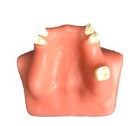 Modèle d'implant dentaire grandeur nature - Modèle d'entraînement de dents maxillaire - Modèle d'entraînement de levage des sinus - Communication médecin-patient - Modèle d'implant dentaire (B)