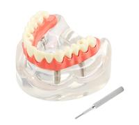 Modèle d'implant dentaire maxillaire amovible 4 implants restauration Overdenture Demom Modèle pour la formation et l'étude des dentistes