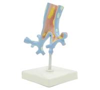 Modèle d'organe Humain Modèle d'anatomie de l'arbre bronchique Humain Modèle bronchique pathologique Modèle pédagogique coloré comme Aides pédagogiques visuelles for l'étude Scolaire