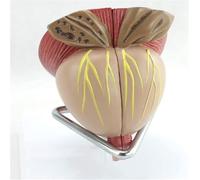 Modèle d'organe Humain : Prostate Masculine, Taille 2 Fois supérieure à la réalité, détachable en 4 Parties. Outil pédagogique et matériel didactique.