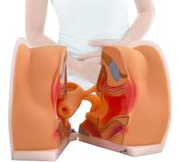 Modèle d'orientation contraceptive gynécologique, modèle de formation sur le DIU, affichage de la structure de l'ovaire du vagin de l'utérus cervical, for l'enseignement de la physiologie