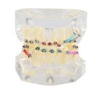 Modèle d'orthodontie de dent déformée Modèle de dent de malocclusion Modèle de dent de mauvaise morsure Modèle pathologique oral Modèle dentaire typique avec chaîne métallique pour la recherche sur l'