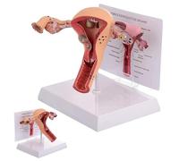 Modèle d'utérus et d'ovaire féminins, modèle d'utérus pathologique, modèle d'organe reproducteur féminin, modèles anatomiques d'utérus humain avec fiche pédagogique et socle