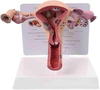 Modèle d'utérus et d'ovaire, système reproducteur féminin, | Modèle anatomique d'utérus et d'ovaire pathologiques destiné à l'enseignement scolaire