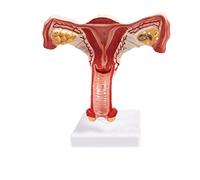 Modèle d'utérus Humain et d'ovaire, vagin utérin pathologique féminin Génito-urinaire Enseignement médical Anatomique GY