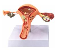 Modèle D'utérus, Organe Reproducteur Féminin-Genovation