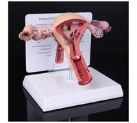 Modèle d'utérus pathologique et normal, modèle d'organe reproducteur féminin, modèles anatomiques d'utérus, avec fiche pédagogique et socle, pour démonstrations scolaires(A)