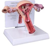 Modèle d'utérus pathologique féminin, ovaire Vaginal, enseignement | Modèle d'ovaire de l'utérus féminin, modèle d'anatomie for cabinet médical et salles de classe, outil éducatif