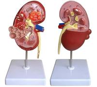 Modèle éducatif rénal, 2 parties détachables, 24 instructions de position anatomique du modèle rénal étiqueté numériquement, for démontrer la structure et la fonction du rein humain.