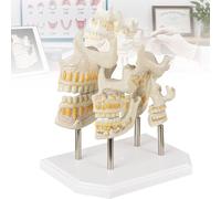 Modèle Évolution Dentaire 4 Étapes Dents de Lait et Permanentes Croissance Typodont Amovible Démonstration Anatomie Remplacement Dentaire pour Dentiste Étudiant Médecine École
