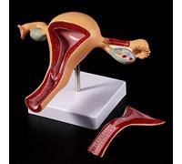 Modèle féminin de l'ovaire utérin, à partir du modèle de Reproduction Interne féminin de l'utérus pathologique Humain, a