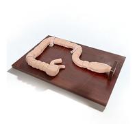 Modèle grandeur nature de pathologie du côlon, simulateur de sigmoïdoscope humain, système digestif, modèles d'étude anatomique du gros intestin, mannequin de démonstration de coloscopie