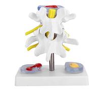 Modèle Lombaire Anatomique, Démonstration Herniation Disque Lombaire, Modèle Colonne Vertébrale Humain pour Formation Médicale Scolaire
