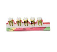 Modèle parodontal Dentaire, Modèle pour l'éducation des patients dentaires, La maladie parodontale dentaire prématurée associe le modèle pédagogique des études sur les dents de dents