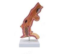 Modèle pathologique de l'œsophage humain, modèle longitudinal du système digestif du cancer de l'œsophage, grossissement réel 5X, avec support d'exposition, for les démonstrations