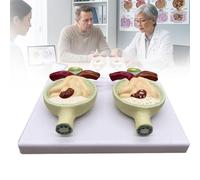 Modèle pathologique de protéinurie, modèle pédagogique biologique avec socle, modèle de néphron et de glomérule rénal pour la communication médecin-patient.