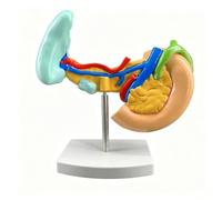 Modèle pathologique du pancréas, de la rate et du duodénum humains-Model