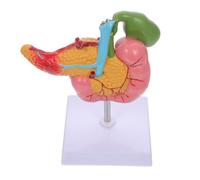 Modèle Pathologique du Pancréas Vésicule Biliaire en PVC | Modèle D’enseignement Biologique, Rendu Réaliste et Très Détaillé, pour Démonstration Scolaire en Sciences