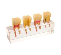 Modèle Pédagogique Dentaire pour Dents de Lait, Résine, Coupe | Sections Transversales Précises, Dents Amovibles, Textures Réalistes, pour Cours D’hygiène Buccale et Cabinet